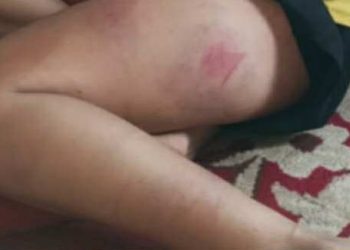 नाबालिका छोरीमाथि आफ्नै बाबुद्वारा लगातार ६ वर्ष बलात्कार, उजुरी दिएको भन्दै नाबालिकाकी आमामाथि निर्घात कुटपिट